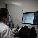 Parkinson: une maladie fréquente mais encore mal comprise