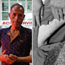 Aydın'da başıboş köpek dehşeti: Oğlunu kurtarmak isterken kendisi yaralandı