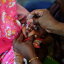 Guinée: une épidémie de diphtérie fait une soixantaine de morts