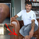 Yıllardır acı içinde yaşıyor: 16 yıl önce ameliyatta unutulduğu ortaya çıktı