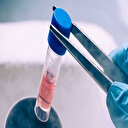 Belçikalı doktorlar Türkiye'yi işaret etti: Haydi Türkiye sen de Yasin'e umut ol!