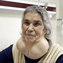 Nedenini duyan inanamadı: Yıllarca boynundaki devasa kitleyle yaşadı