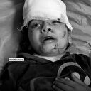 Katil İsrail'in saldırısından yaralı kurtulan Gazzeli minik kız: Annem şehit oldu Allah rahmet eylesin