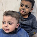 Kendi yaralarını unutan Gazzeli çocuk küçük kardeşini teselli etmeye çalıştı