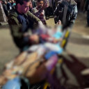 İsrail bombardımanında yaralanan kardeşler aynı sedyede taşındı