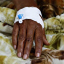 Mozambik'te kolera salgını: İki haftada bin 100 yeni vaka tespit edildi