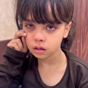 İsrail bombardımanında ayağından yaralanan Rital 1 aydır tedavi edilmeyi bekliyor