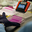 Les cas de cancer devraient augmenter de 55 % d'ici 2040 par rapport à 2020