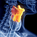 Karaciğer kanserinin önüne ilaçlarla geçilebilecek