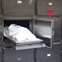 Harvard Tıp Fakültesi'nin skandal: Kadavra parçaları satılıyor