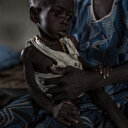 Afrique: Au moins 216 millions d'enfants souffrent de retards de croissance et de malnutrition