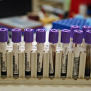 OMS: la moitié de la population mondiale est exposée au risque d’infection à la dengue 