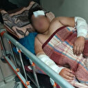 Konya'da başıboş sokak köpeklerinin kovaladığı çocuk yaralandı