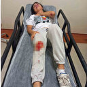 Başıboş sokak köpeklerinin saldırdığı genç kadın ölümden döndü