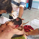 Yine sokak köpeği dehşeti: Ölümden dönen küçük çocuğun kafasına 25 dikiş atıldı