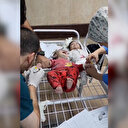 Gazze'de çocuklar yerde ya da yataksız karyolalarda tedavi ediliyor