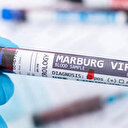 Le Rwanda commence la vaccination contre le virus de Marburg