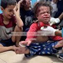 İşgalci İsrail katliamın 1'inci yılında yine çocukları hedef aldı: Yaralanan down sendromlu kızın döktüğü gözyaşı yürekleri parçaladı