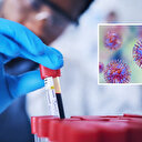 Yüzlerce şişe dolusu ölümcül virüs kayboldu: İmha mı edildi?