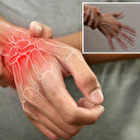 Ellerinize çok dikkatli bakın: İngiliz dermatolog eklem ağrısı ve titremeye dikkat çekip tüm belirtileri tek tek sıraladı