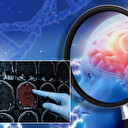 Bu belirtilere aman dikkat: Fark etmeden beyin kanaması geçiriyor olabilirsiniz