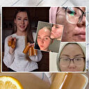 Bu tarif cildi bebek gibi yapıyor: Sadece 3 malzeme! Sosyal medya fenomenlerinin en büyük güzellik sırrı... Sivilceden eser bırakmıyor