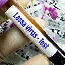 Nigeria: la Fièvre de Lassa fait 20 morts en une semaine