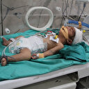 UNRWA: "Les nourrissons à Gaza meurent lentement sous les yeux du monde"