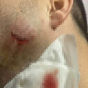 Valilik duyurdu: Kavgada sağlık çalışanını ısıran jandarma açığa alındı