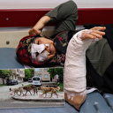 Köpeklerden kurtulmaya çalışan kadın merdivenlerden yuvarlandı