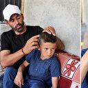 Köpek ısırması nedeniyle 6 ameliyat geçirmişti: Yedi yaşındaki Emir'in başında saldırının izleri kaldı