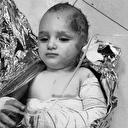 İsrail saldırısında yaralanan bebek korkuyla titredi