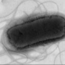 İngiltere'de koli basili salgını 