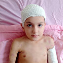 Köpeklerin ağır yaraladığı Tunahan eve kapandı herkesten kaçıyor: Babası 'Yaşaması bile mucize' diyerek anlattı