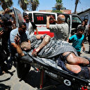 Gaza: Les armes israéliennes provoquent d'étranges blessures et défigurations