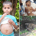 Köpeklerin saldırdığı minik Abbas 18 gün sonra taburcu oldu: Tehdit devam ediyor!