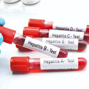 Kişisel eşyada hepatit riski