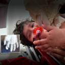 Uzman doktor aileleri uyardı: Vantilatör bir yaşındaki bebeği parmağından etti