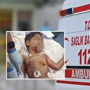 Başıboş köpekler dehşet saçtı: 5 yaşındaki çocuk ağır yaralandı