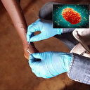 AB: Maymun çiçeği virüsünden etkilenen bölgelere 215 bin doz aşı göndereceğiz 