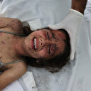 Gaza: "Augmentation effrayante" des cas d'hépatite selon l'UNRWA