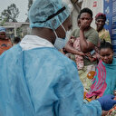 RDC: Un millier de cas de Mpox en une semaine