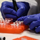 Avrupa'da M çiçeği uyarısı: Risk düşük ancak ithal vakalar artabilir