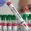 Bir rehber de İletişim Başkanlığından: İşte Maymun çiçeği hastalığına ilişkin merak edilenler