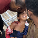 Yaralı kız babasına seslendi: Babacığım seni bir kez öpeyim