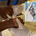 ABD gönderdi: Nijerya'ya 10 bin doz M çiçeği aşısı