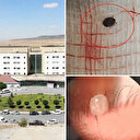 12 yaşındaki çocuğun gözünden çıktı! Bu belirti varsa hemen hastaneye koşun