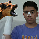 Yine sahipsiz köpek yine dehşet: Küçük çocuk ölümden döndü