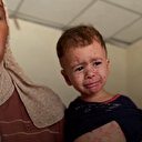 Gazzeli çocuklarda cilt hastalıkları hızla yayılıyor