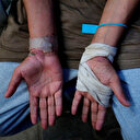 Gazzeli esirler İsrail'in işkencelerini anlattı: Kaynar su dökerek yaktılar